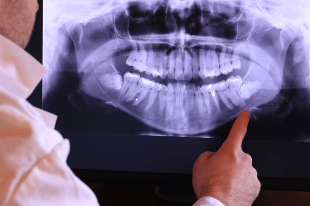 Best Emergency Dentist for Knocked-Out Tooth in Republic, MO