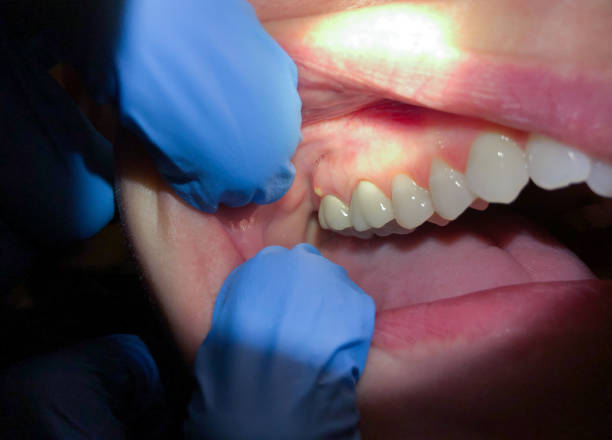 Best Emergency Dental Extractions in Republic, MO